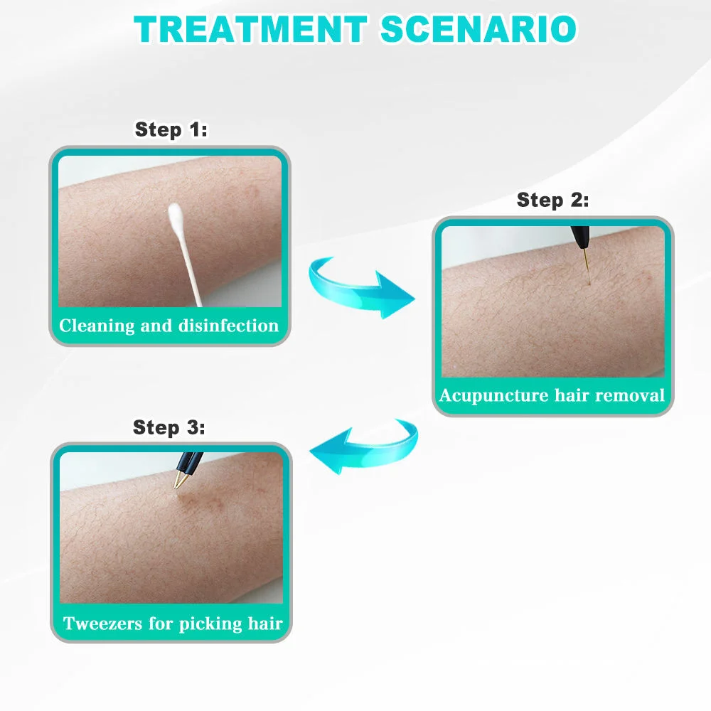 Factory Price CE ROHS High-frequency Rapid Epilator Device Painless Blend Electrolysis Hair Machine Removal for Grey Hair