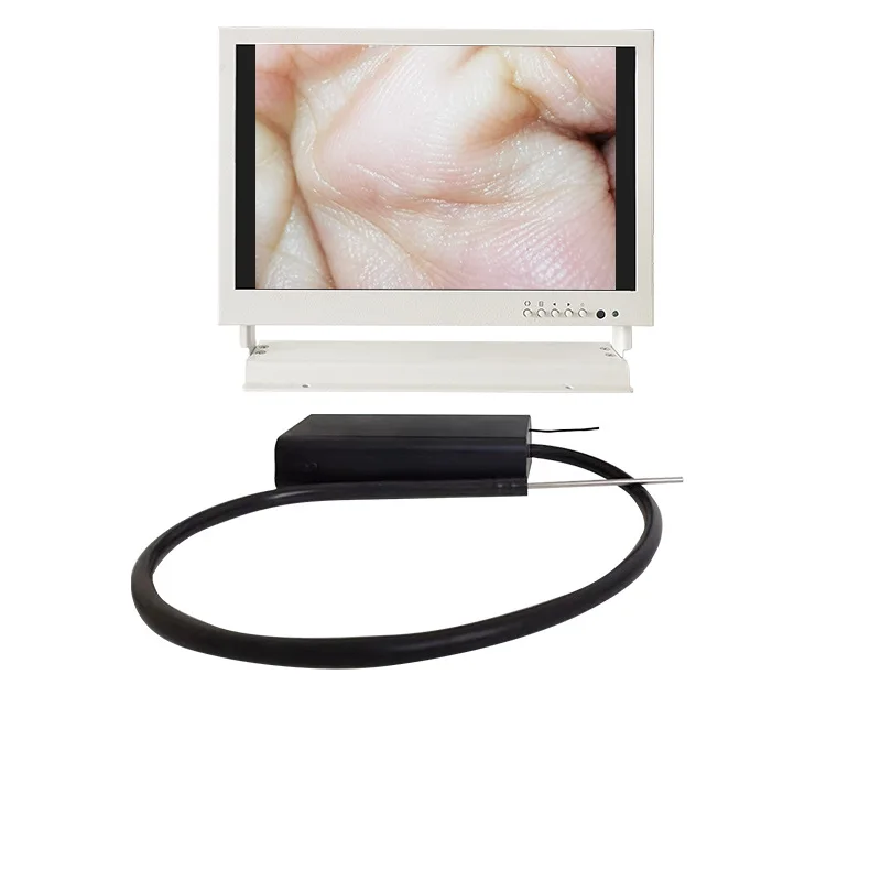 1.7Mm wireless visual ear picking hose otoscope cold light source endoscope high definition large screen display ear picking