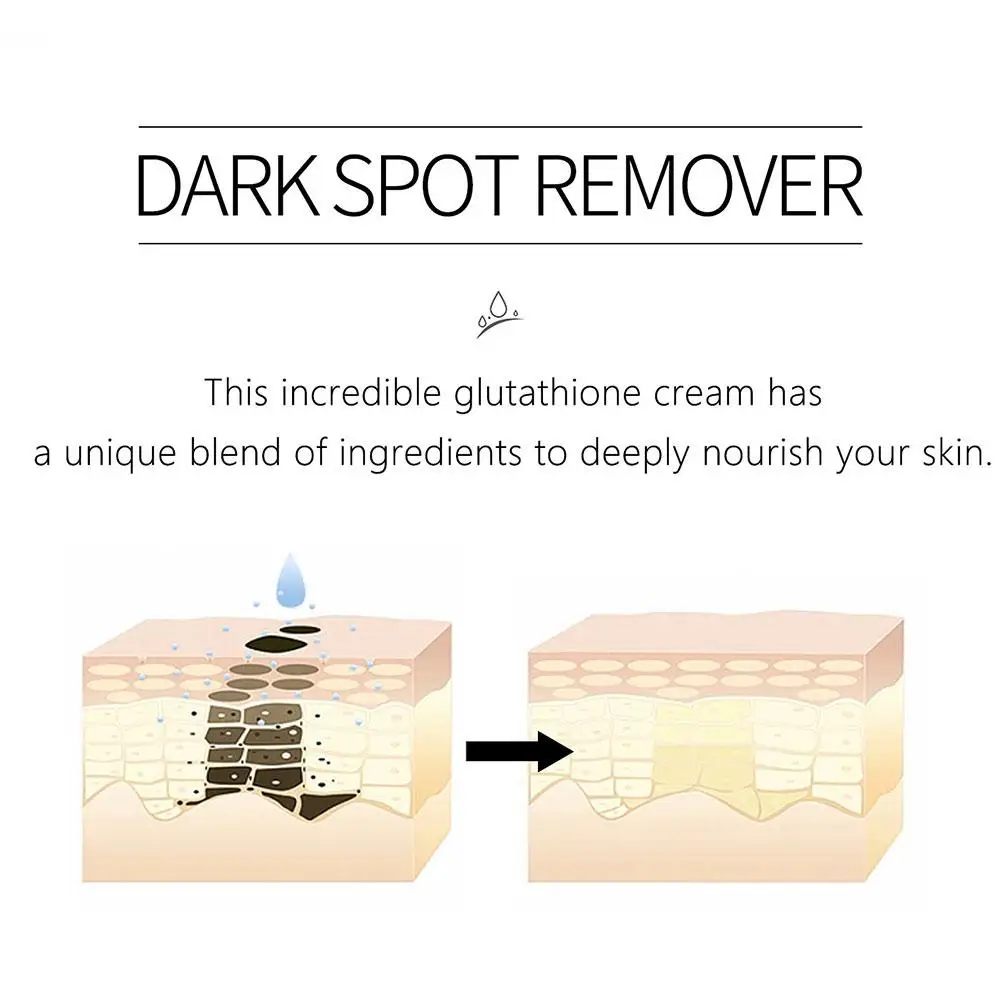 Lanthome Dark Spots Corrector Glutathion Haut Bleaching Creme Feuchtigkeitsspendende Aufhellen Straffen Reparatur Beschädigte Haut Für Gesicht Ca D0R6