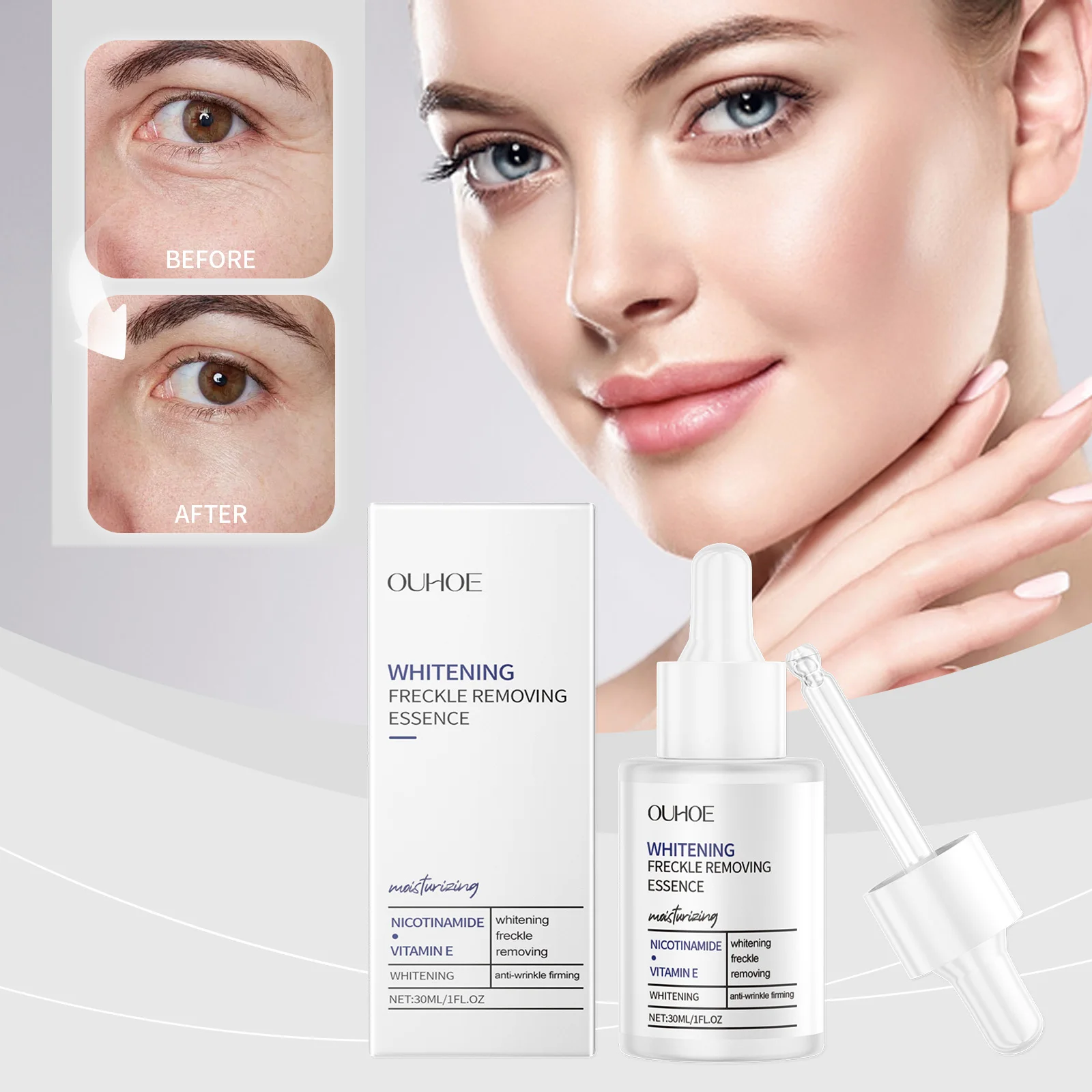 Siero sbiancante alla nicotinamide: schiarente, rimozione delle lentiggini, correttore delle macchie scure per una pelle luminosa