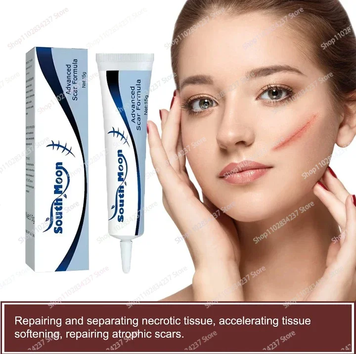 

Acne Scar Stretch Marks Remover Cream Postoperative scar repair Skin Repair Acne Black Dots Spots Acne