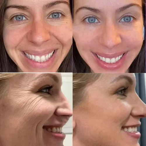 Imagen 2 del producto Nueva crema antiarrugas para la cara efecto instantáneo eliminación de arrugas crema facial antienvejecimiento mejora las líneas finas cuidado nutritivo de la piel