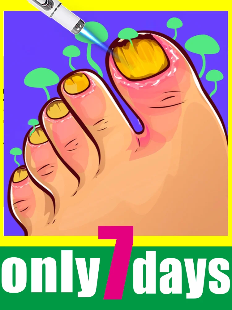 

Лидер продаж 2025, лазерная ручка с синим светом, очистка инфекций ногтей и оттенок ногтей, инструмент для очистки грибка