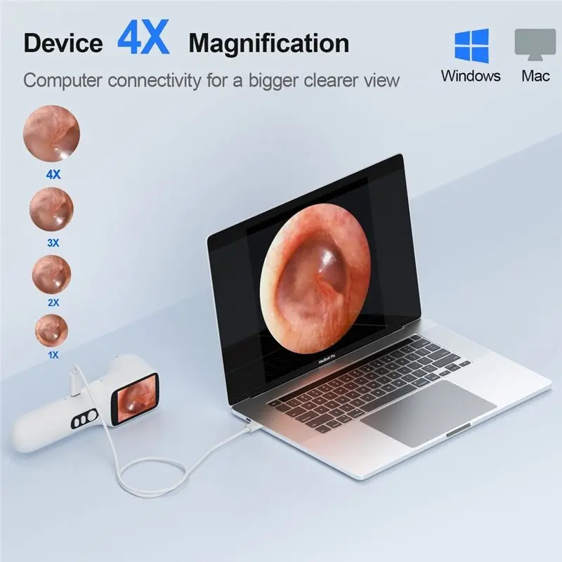 24-hour delivery Smart Visual Ear Camera 720P HD Digital Otoscope, IPS Screen, Ear Scope Camera, Ear Wax Removal Tool