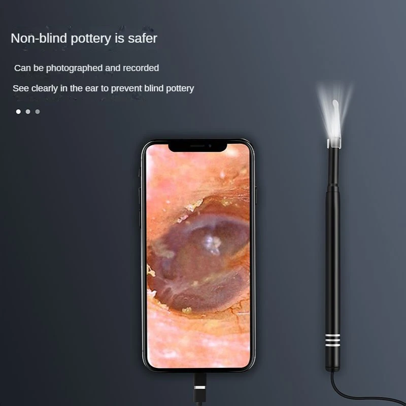 VITCOCO HD 3-In-1 Endoskopi Ponsel USB 5.5Mm Lensa Visual Sendok Telinga