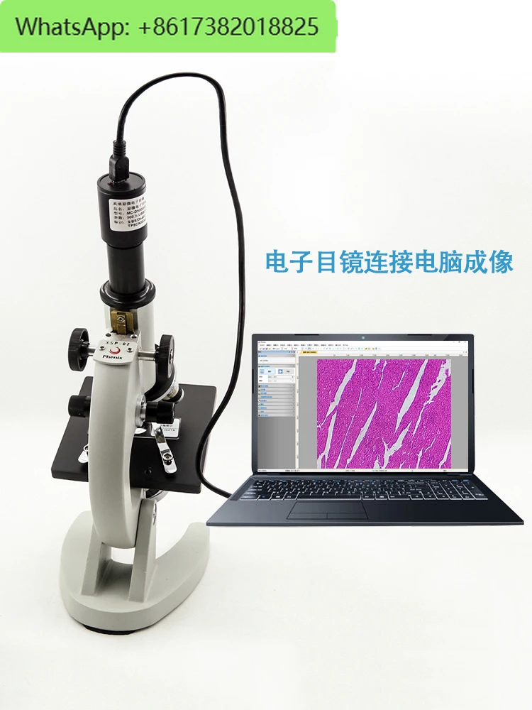 

Microscope display screen camera system CCD high-definition industrial camera (/USB/VGA/AV) connected to TV computer