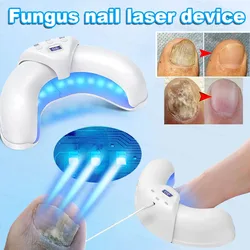 Toenail Fungal Nail Laser Treatment Repair Fast Nails Fungus Onychomycosis Repair Removes Foot Fingernail  Nail Fungus Device