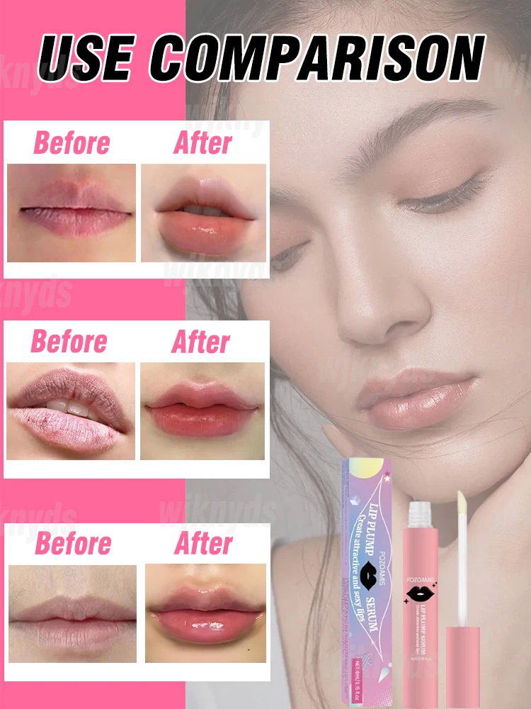 Haga que los labios llenos y la esencia regordeta completa y también es adecuado para personas sensibles.