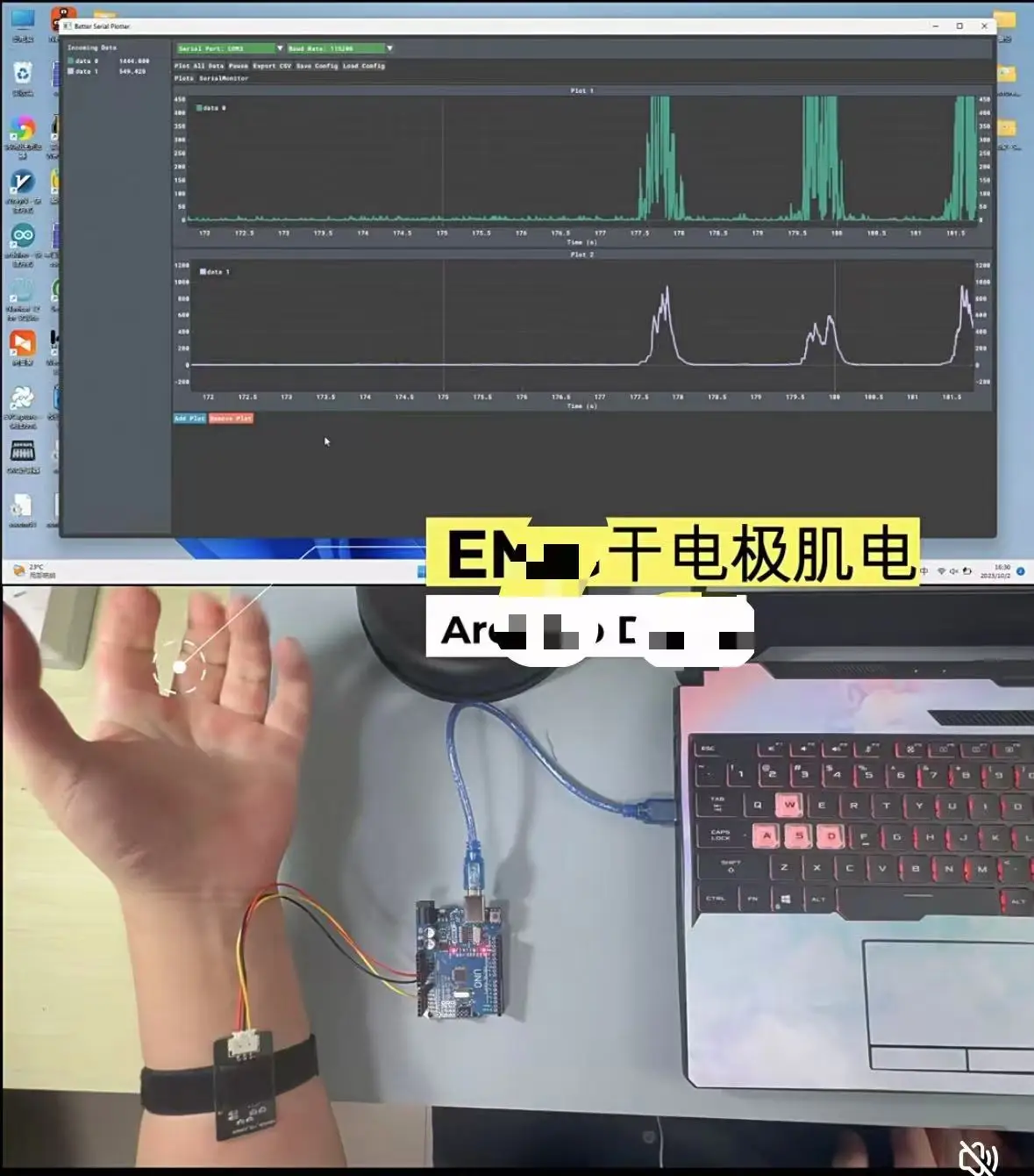 

Development of single-channel surface electromyography, dry electrode electromyography, analog signal with Arduino EPS32