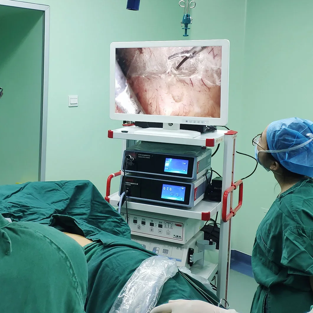 High Brightness 100W Hysteroscope LED Cold Light Source with Endoscope moni tor Price