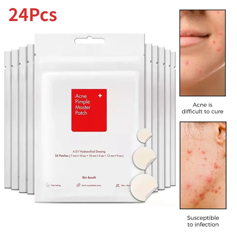 Acne Pimple Spot Cicatriz Cuidado Corretivo Adesivo, Ferramentas De Cuidados Com A Pele Facial, Melhorar A Coceira Facial, Remendos De Limpeza, Produtos De Beleza