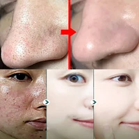 Crème de traitement à l'acide salicylique pour resserrer les pores, éliminer les points noirs, les marques d'acné et les pores dilatés – Produits pour la peau du visage 4