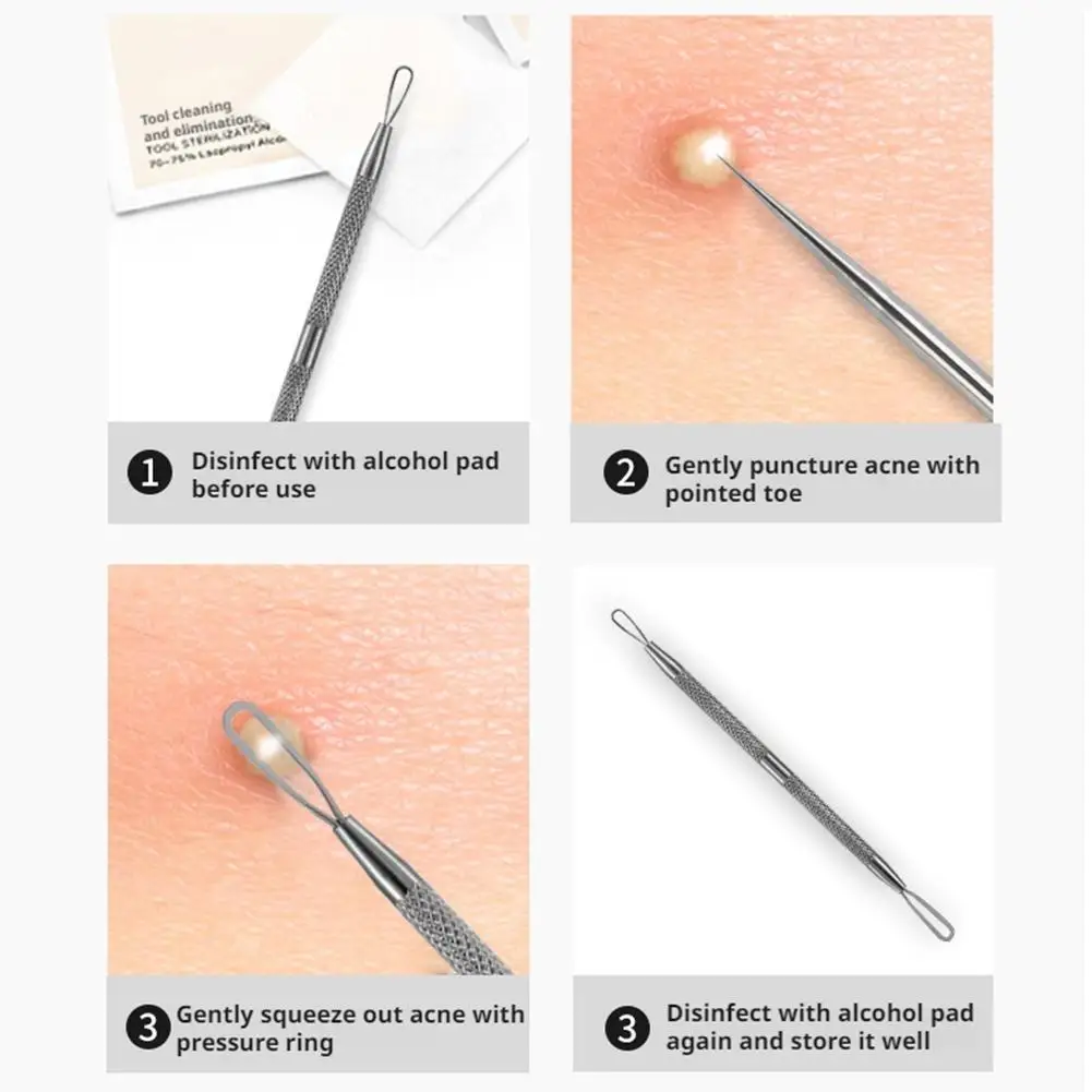 Roestvrij staal Acne Presser Acne Puistjes Mee-eter Extractor Remover Pore Cleaner Gezichtsreinigingstool
