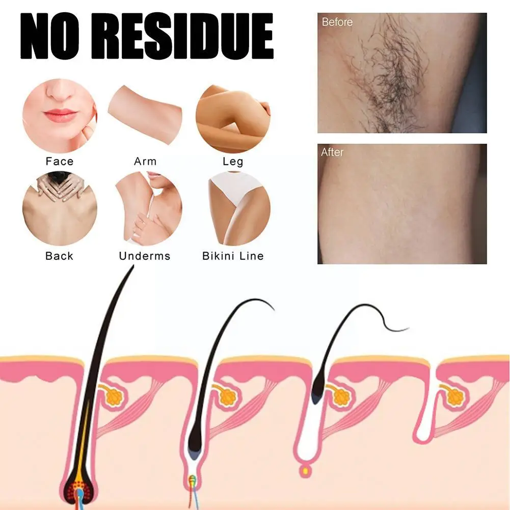 30ml Powerful Hair Removal Spray Super Natural Painless Permanent Hair Remover For Women Men Whole Body Depilatory Cream Z0t6