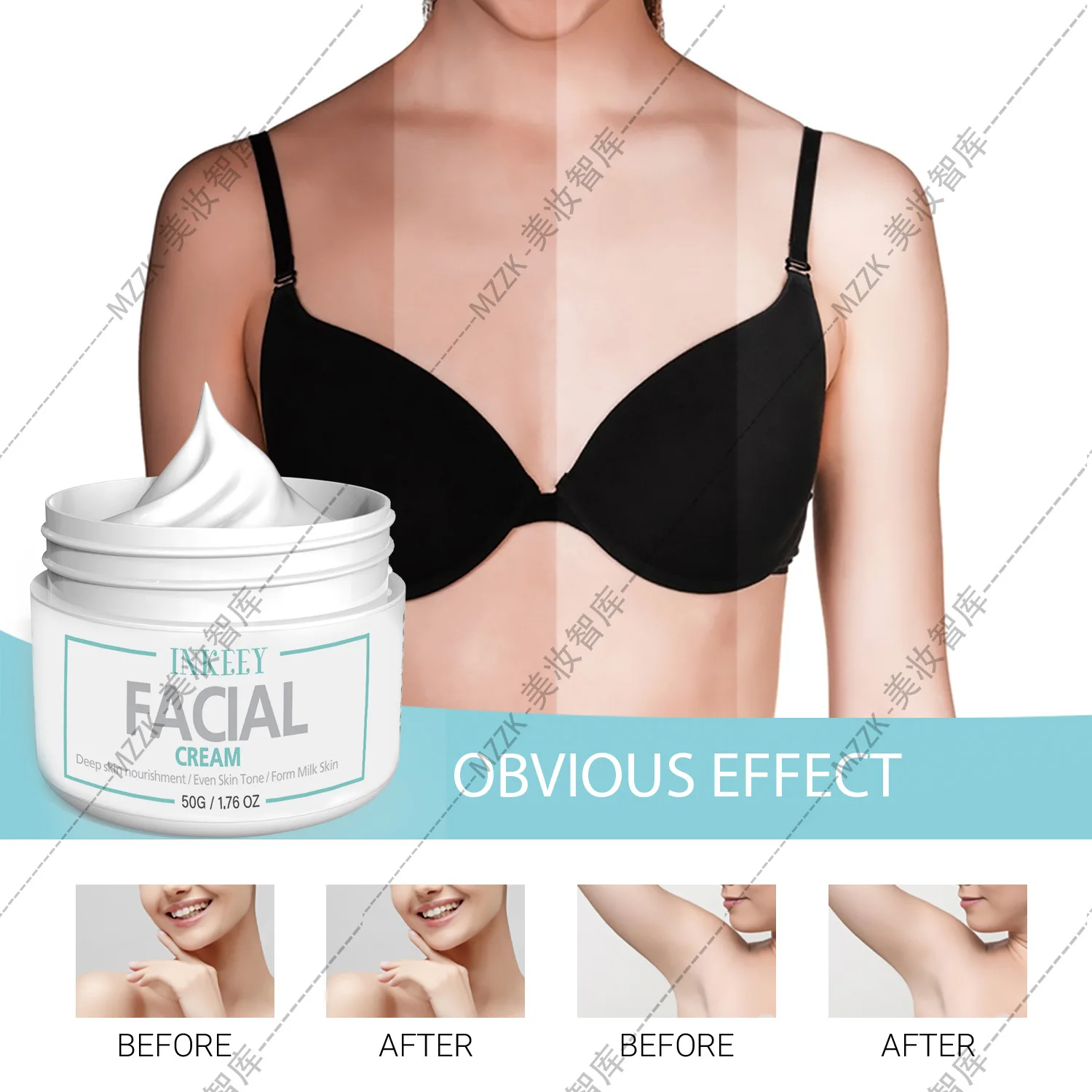 كريم تفتيح الجسم - كريم تبييض الميلانين يتلاشى لتعزيز إشعال البشرة وحتى البشرة