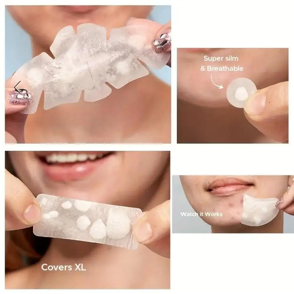 الغروانية المائية حب الشباب بقع بثرة إزالة ملصق غير مرئية تنفس الغروانية المائية حب الشباب التصحيح مكافحة حب الشباب البقع علامات المخفي أماه #6