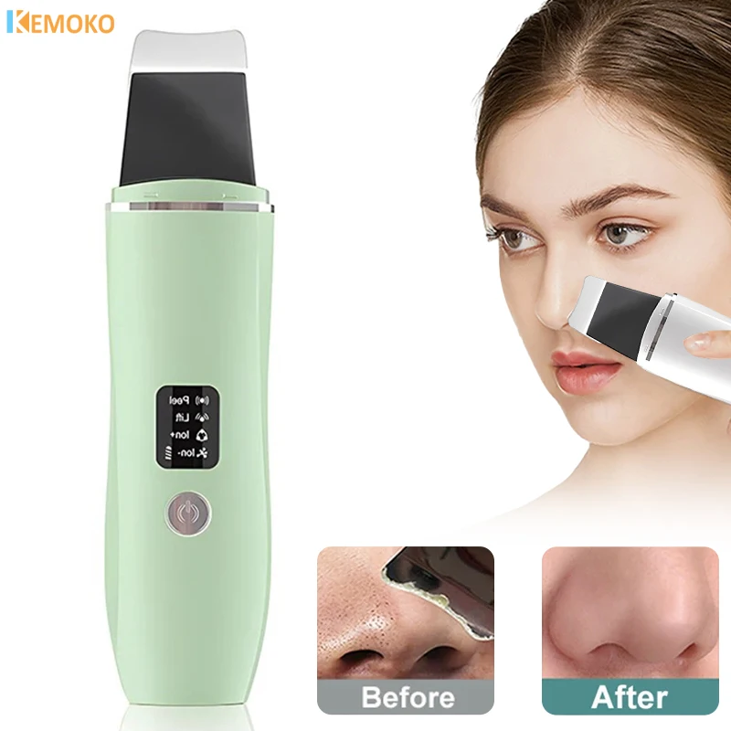 

Ultrasonic EMS Skin Scrubber Blackhead Removal Face Care Cleaning Face Pore Cleaner Shovel Cleanser Acne Blackhead Remover Tools