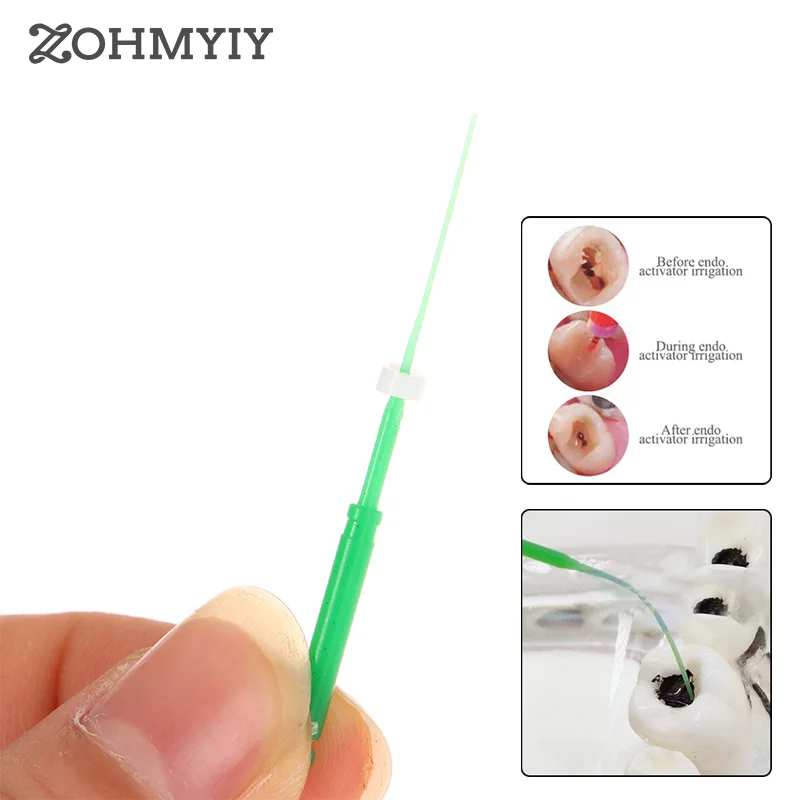 

1Pcs Dental Root Canal Cleaning File Irrigation Tips Fit For Dentistry Air Scaler Handpiece Irrigator Tip Lab Material