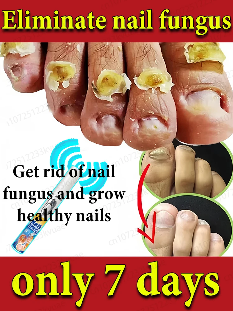 

Professional repair to give your nails a new lease of life