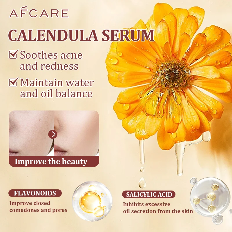 Women Calendula Serum Facial Essence Contains Salicylic Acid Repair Acne Serum Oil Shrink Pore Remove Blackheads Facial Cleaning