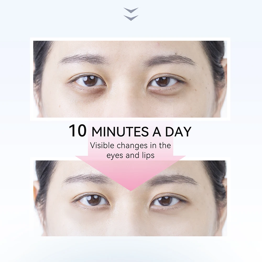 ANLAN Eye Beauty Device Microcurrent Eye Massager Remove Eye Bags Dark Circles Red Blue Light Eye Lifting Massage Instrument
