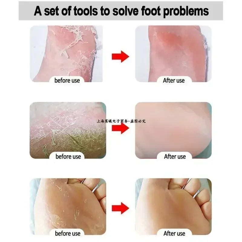 Épurateur professionnel pour pieds en acier inoxydable, 1 paquet, adapté au soin des pieds, élimine les peaux mortes et les callosités, laisser une peau lisse.