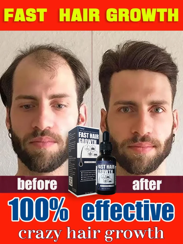 

[THICK HAIR] say goodbye to baldness, have more and more hair, 99% of buyers buy again