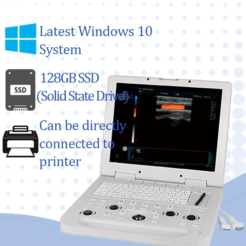 2026 New Laptop 15 Inches Color Doppler Ultrasound Scanner with Convex Probe 3D Color Ultrasound Scanner