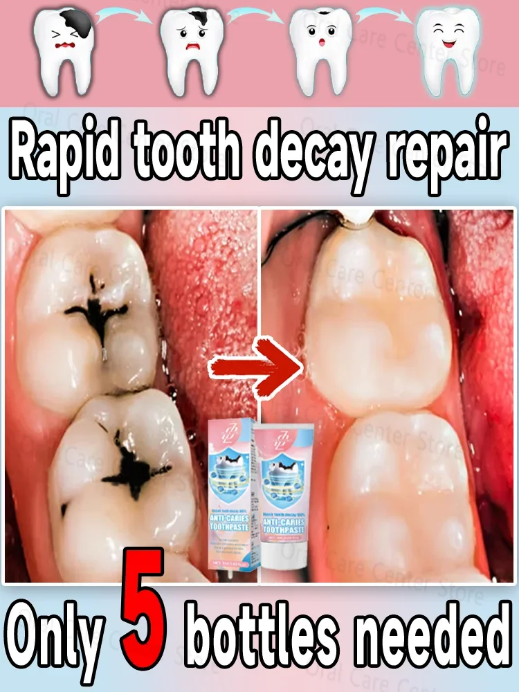 Hot selling product, 99% of buyers will buy again, teeth are getting better and better, fast effect, no more cavities