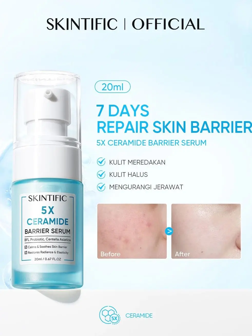5X Ceramide Barrier Repair Serum, Nano-Liposome Deep Hydration, Oil Control Soothing Anti-Acne Facial Serum
