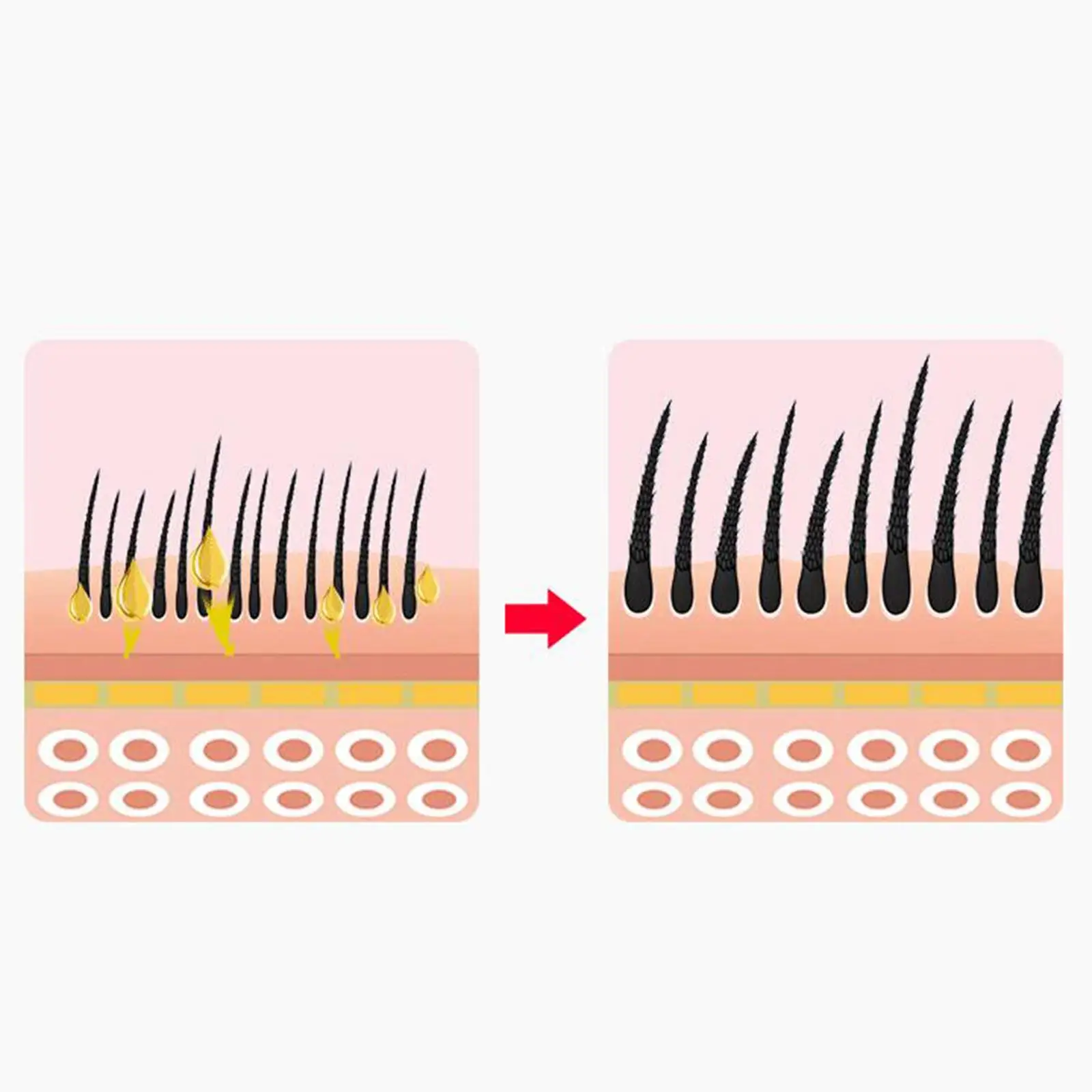 Mini Scalp Applicator Comb for Essential Oil Serum Rolling Ball Massage Brush Portable Hair Root Fluid Dispenser Travel Size