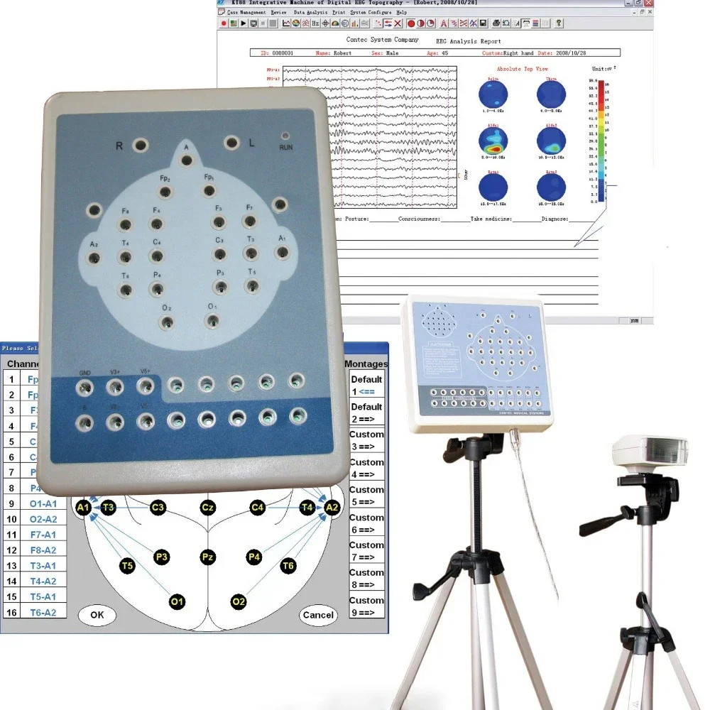 Equipo Médico Digital de 16 canales, mapeo de actividad cerebral, electroefaloboblografía, máquina de EEG, ambulatoria