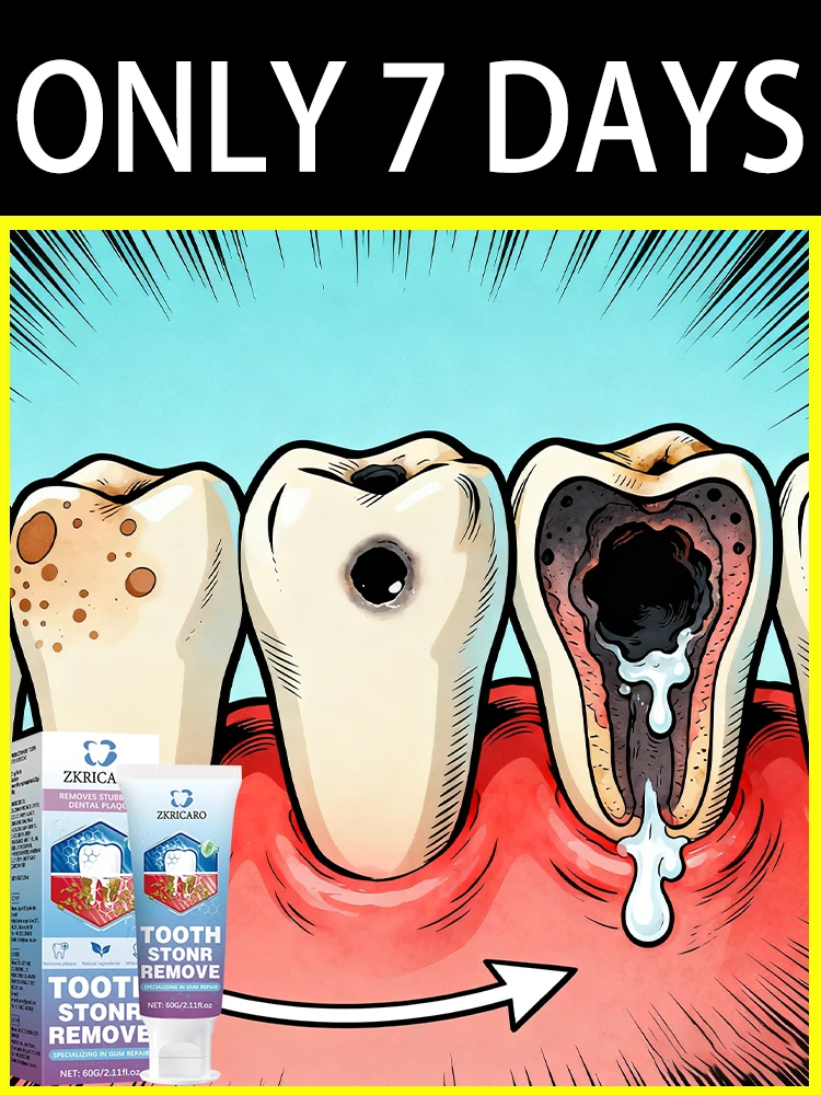 Sᴀʏ ɢᴏᴏᴅʙʏᴇ ᴛᴏ ғʀᴀɢɪʟᴇ ɢᴜᴍs ᴀғᴛᴇʀ 7 ᴅᴀʏs ᴏғ ᴄᴏɴsɪsᴛᴇɴᴛ ᴜsᴇ #1