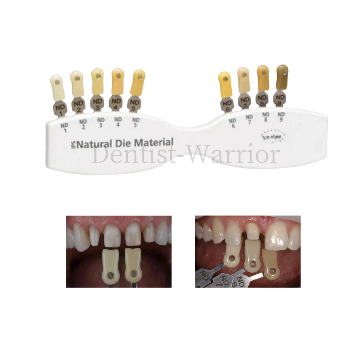 Dental Teeth Shade Guide 20 Color A-D Shade Guide Bleach Natural Die Veneer Template
