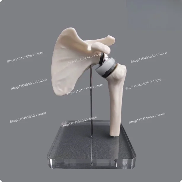 Compact Shoulder Arthroplasty Simulation Model for Orthopedic Surgeon Training & Patient Communication, Clinical Skills Teaching