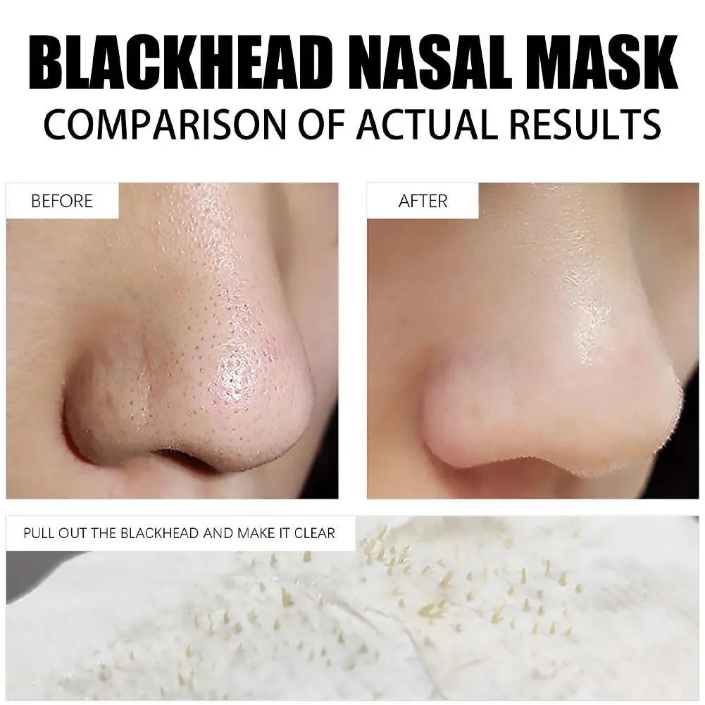 Blackhead Remover Nose Mask Pore Strip Tearing Mask Care Deep Acne Deaning Peeling Black Treatment Dots Skin Nasal Patch hot