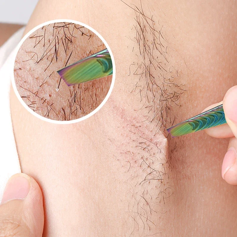 Verwijdering Clip Vrouwen Professionele Wenkbrauw Pincet Trimmer Mannen Baard Wimper Brow Roestvrij Haar Plucker Voor Gezicht Lash Makeup Tools