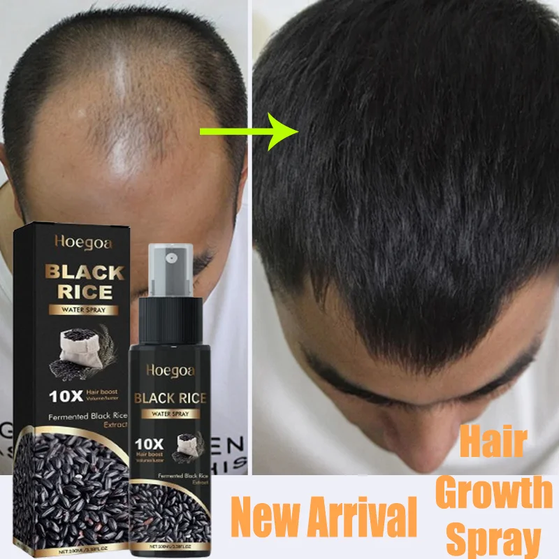 Black Rice Water Hair Growth Spray Deep Nourishing Prevent Loss Strengthen Hair Scalp Care Solution For Dense Hair Serum Product