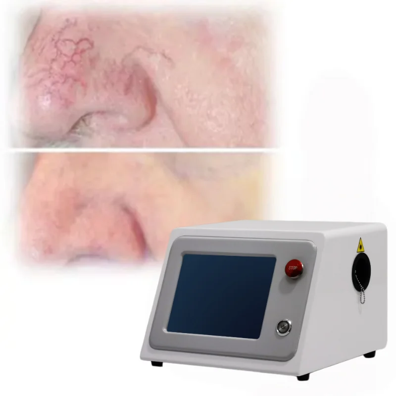 2026 New Upgrade Portable Red Blood Vessel Spider Vein Removal Capillary Removal 980nm Diode Laser Vascular Treatment Machine