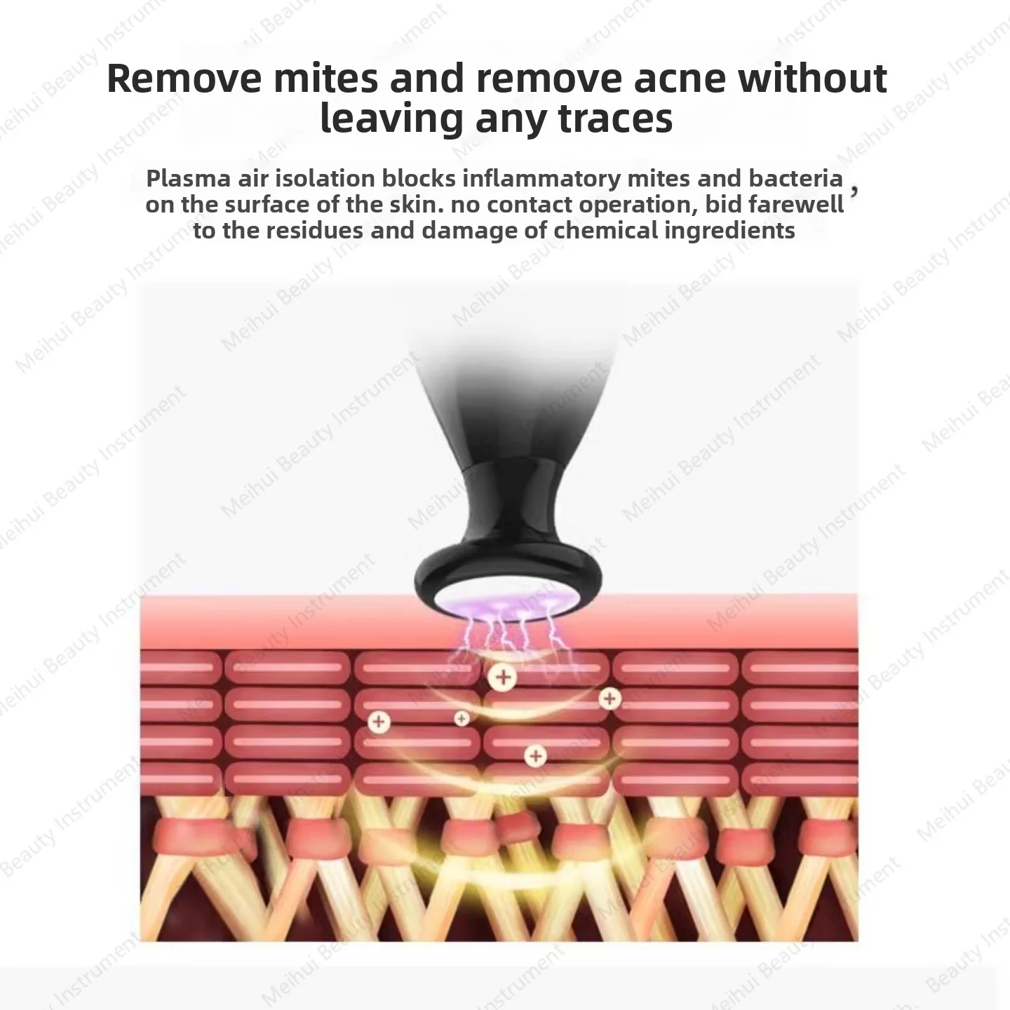 Plasma Air Acne Removal Instrument Household Facial Ozone Ion Beauty Instrument Electrotherapy Instrument