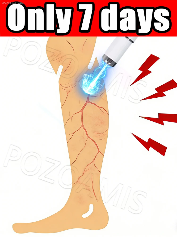 

Подходит как мужчинам, так и женщинам, эффективно устраняет сосудистые проблемы.