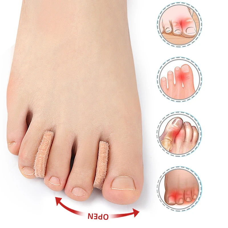 10PCS Felt Toe Straightener Thumb Eversion Overlapping Toe Separator Daily Toe Divider With Large Foot Bone Eversion Foot Care