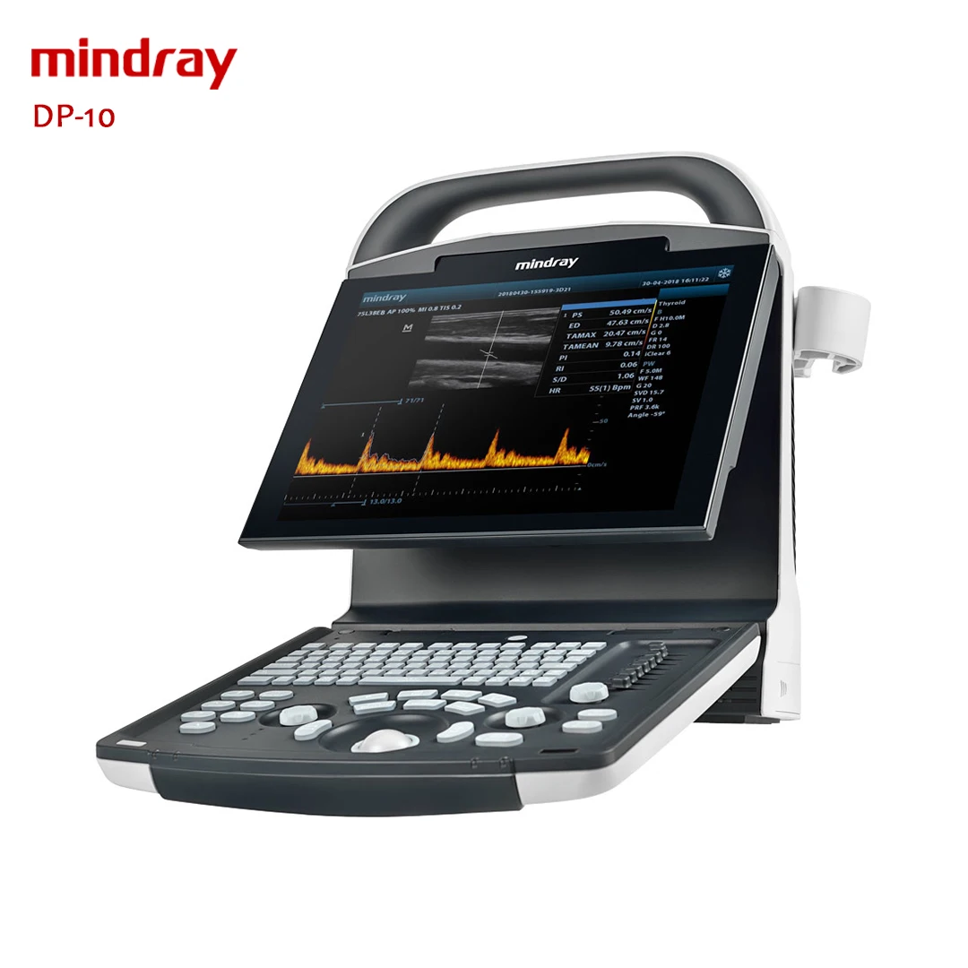 Mindray ultrasound dp 10 cheaper price Medical Ultrasound Instruments for hospital use