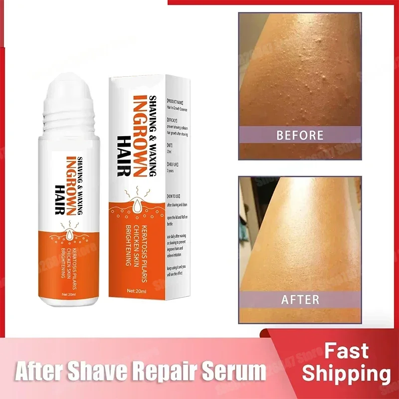 After Shave Serum Razor Bump Stopper for Men Women Waxing Ingrown Hair Remover Reduce Redness Skin Soothes Moisturizes Solution