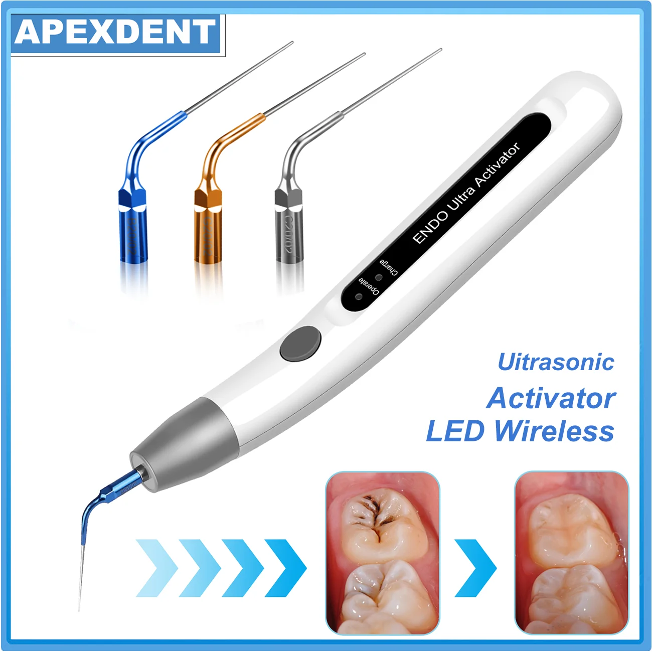 

Светодиодный ультразвуковой активатор для стоматологии с 3 насадками, беспроводной эндодонтический ирригатор для промывания корневых каналов, стоматологические инструменты