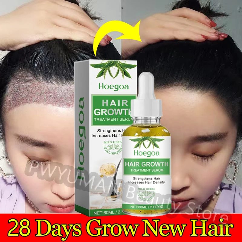 

Effective Hair Growth Oil Anti-Loss Prevent Baldness Traction Alopecia Serum Repair Scalp Damage Thicken Hair For Man Women 60ml
