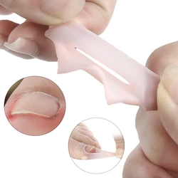 20Pairs Gel Toe Nail Straightening Clip Brace Foot Care Tools Silicone Ingrown Toenail Correction Invisible Ingrown Treatment