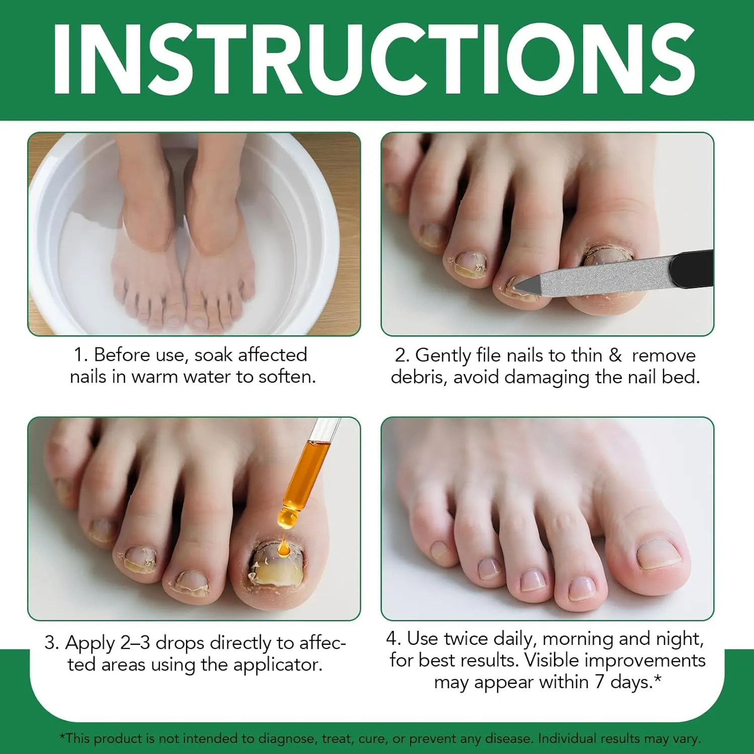 سائل إصلاح الأظافر 30 مل حل علاج فطريات الأظافر Tinea Unguium للأظافر المتغيرة اللون والتالفة