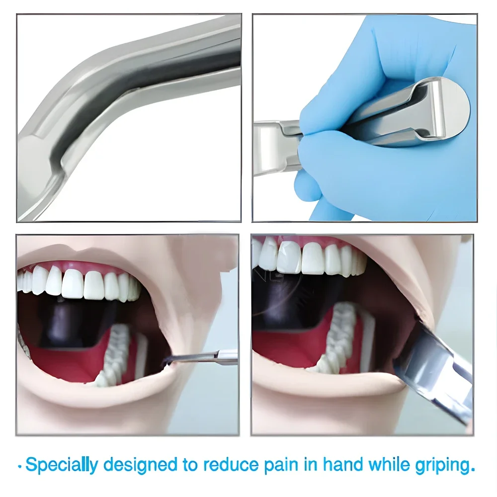 XYSZ-Écarteur de joues dentaire BleJules, ouvre-bouche pour implant, écarteur buccal en acier, outils de dentiste, 1 pièce