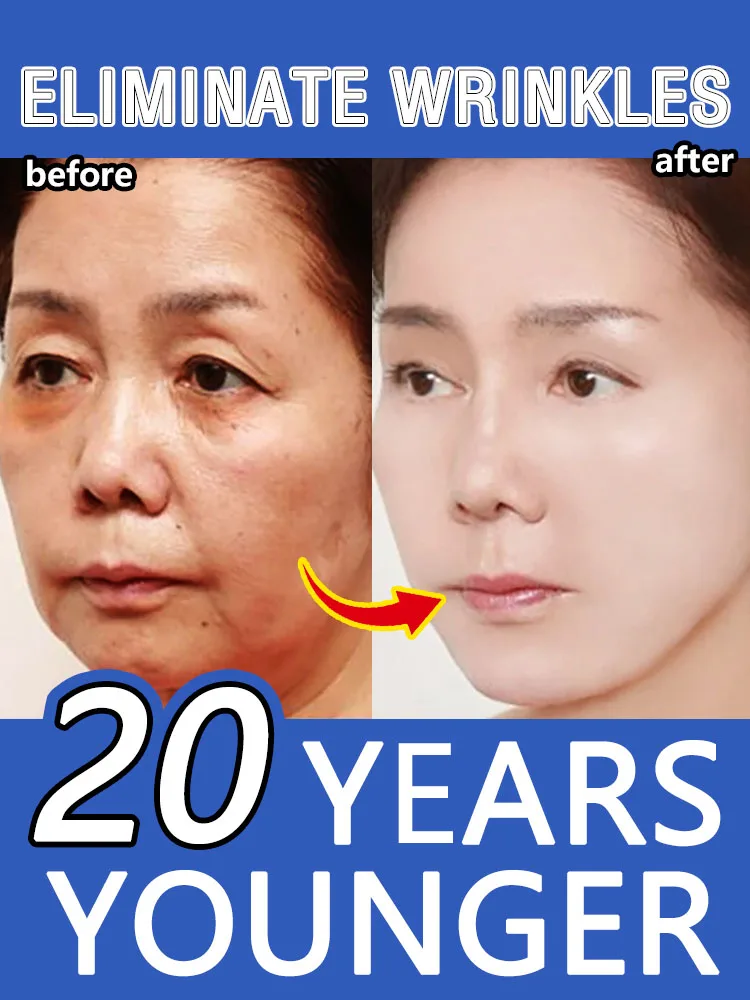 

Anti-wrinkle essence removes wrinkles, eye lines, nasolabial lines, forehead lines